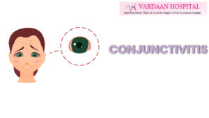 All You Need To Know About Conjunctivitis