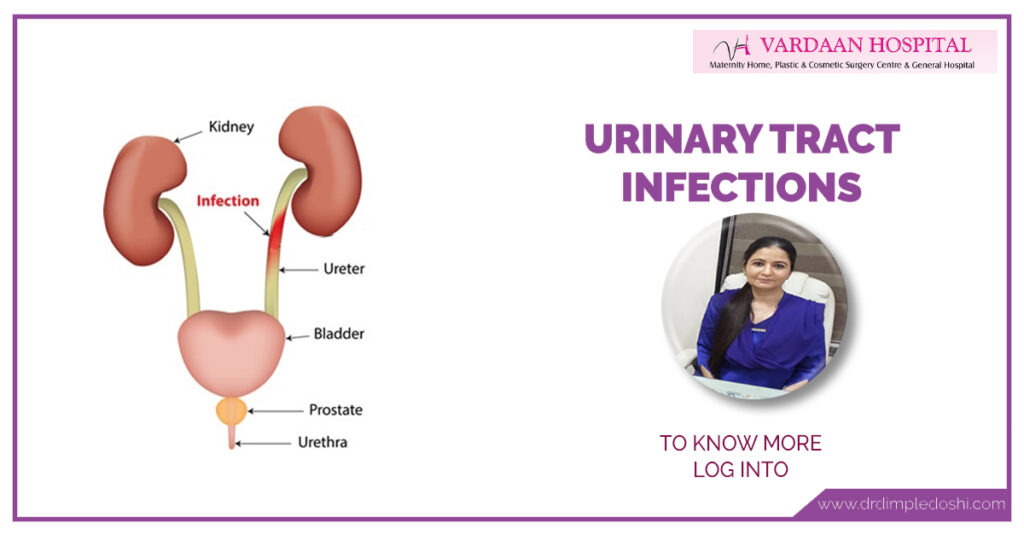 Urinary Tract Infections of woman