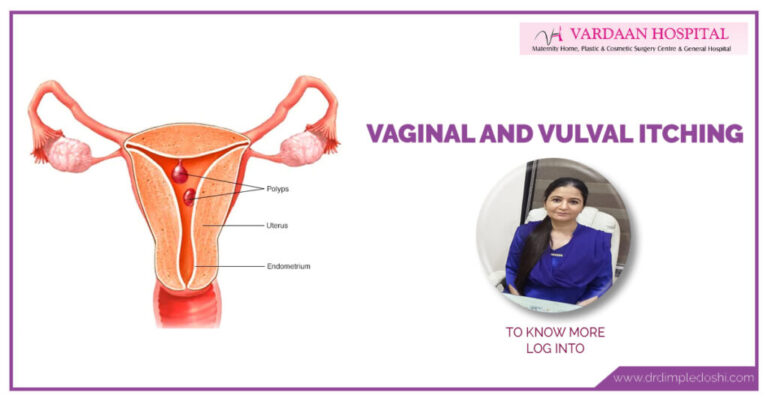 Vaginal-and-vulval-itching