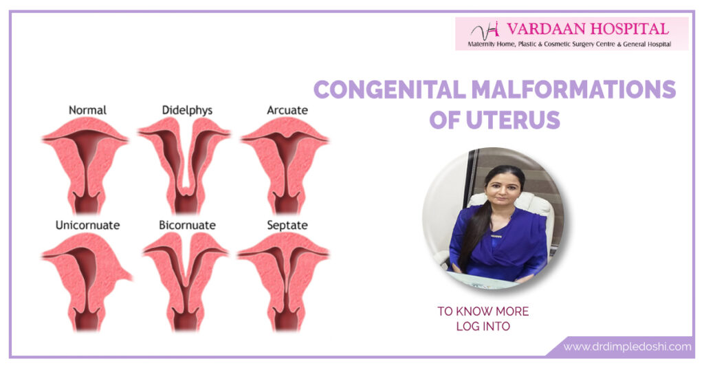 Congenital-malformation-of-uterus