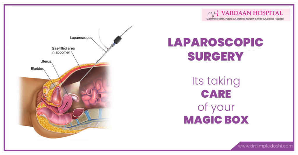 laparoscopic-suregery