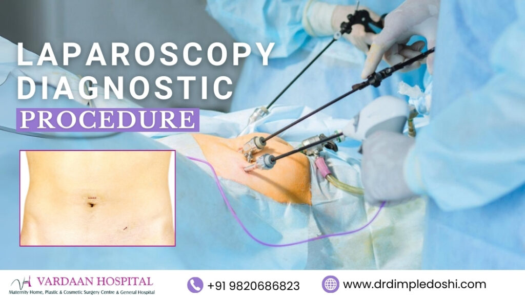 Laparoscopy Diagnostic Procedure