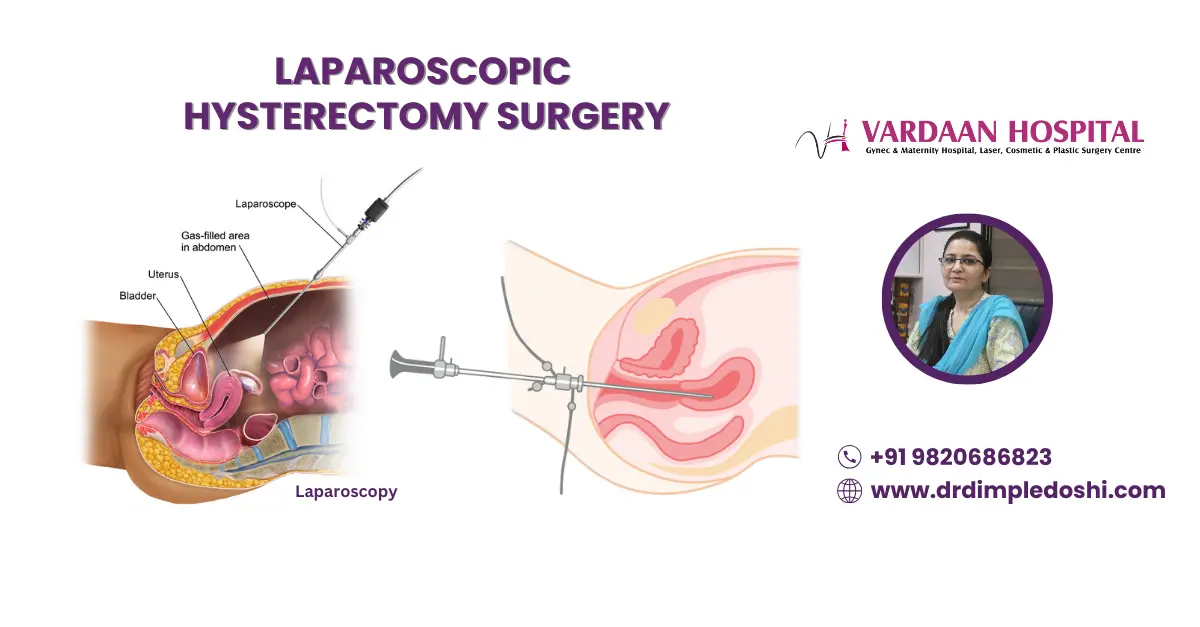 Laparoscopic Hysterectomy Banner