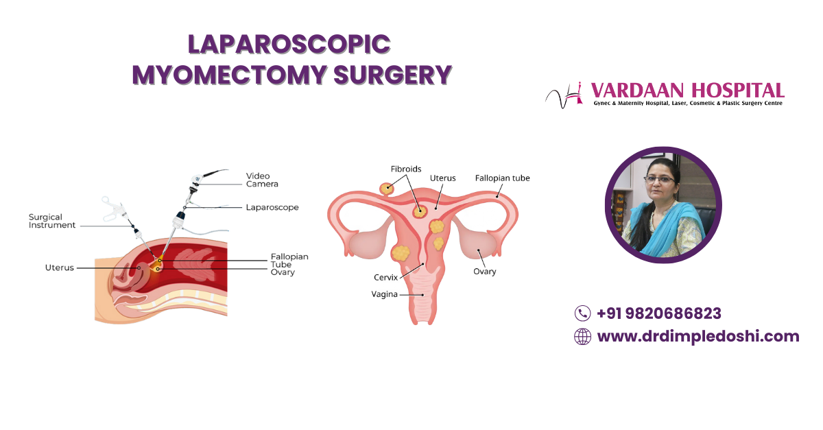 laparoscopic myomectomy surgery Banner