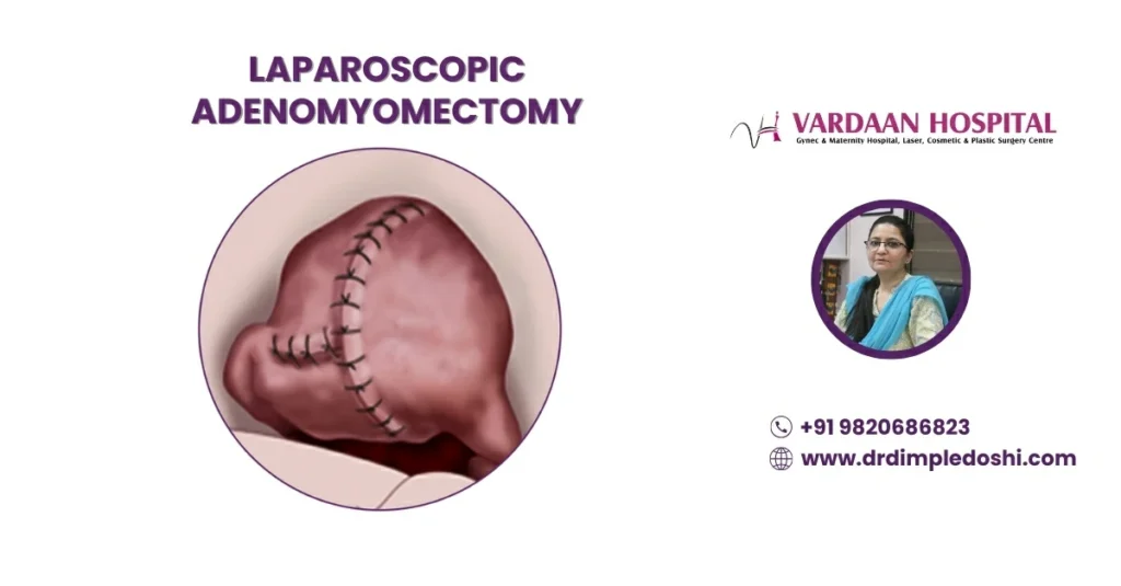 Laparoscopic Adenomyomectomy Banner Image