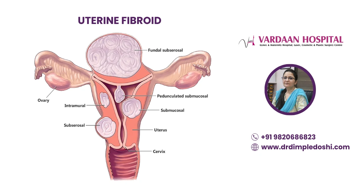 Uterine Fibroid Banner Images