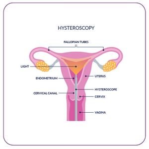 HYSTEROSCOPY