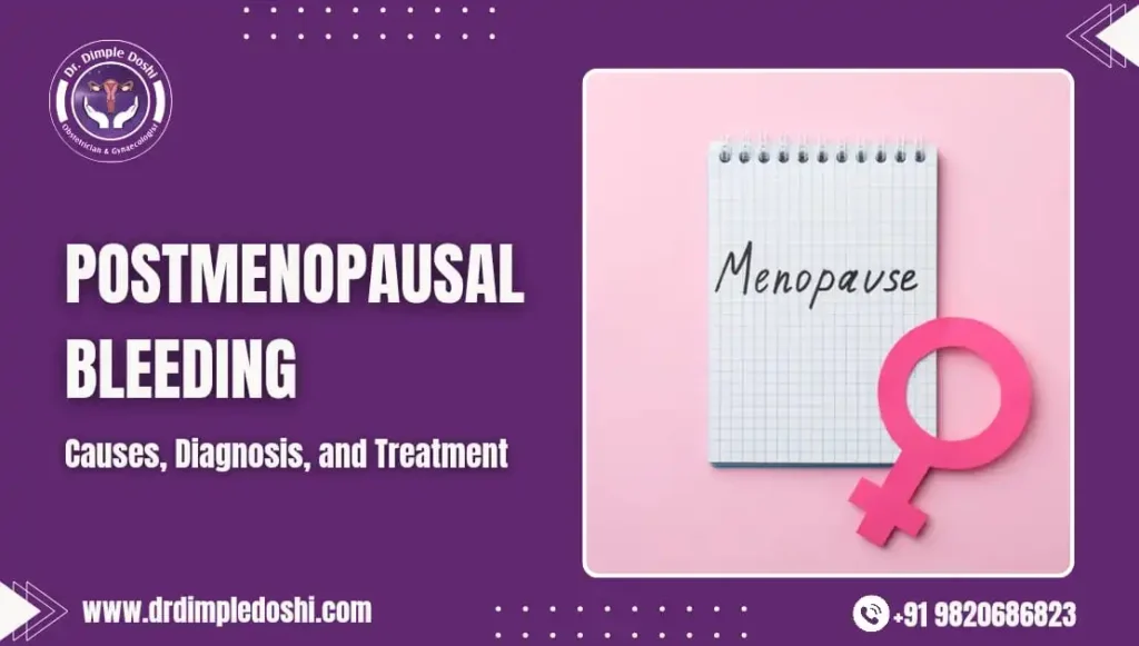 Postmenopausal Bleeding Causes, Diagnosis, and Treatment