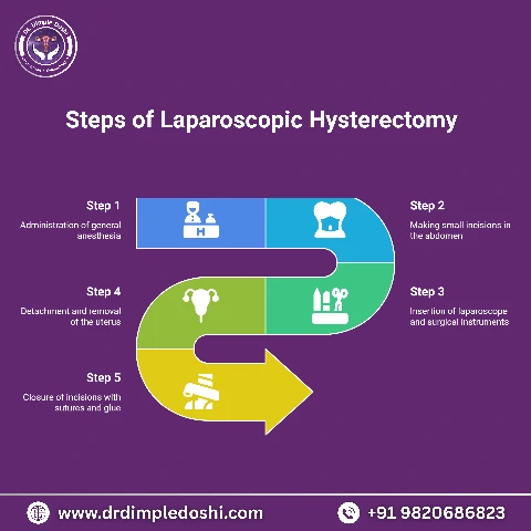 Steps of laparoscopic hysterectomy