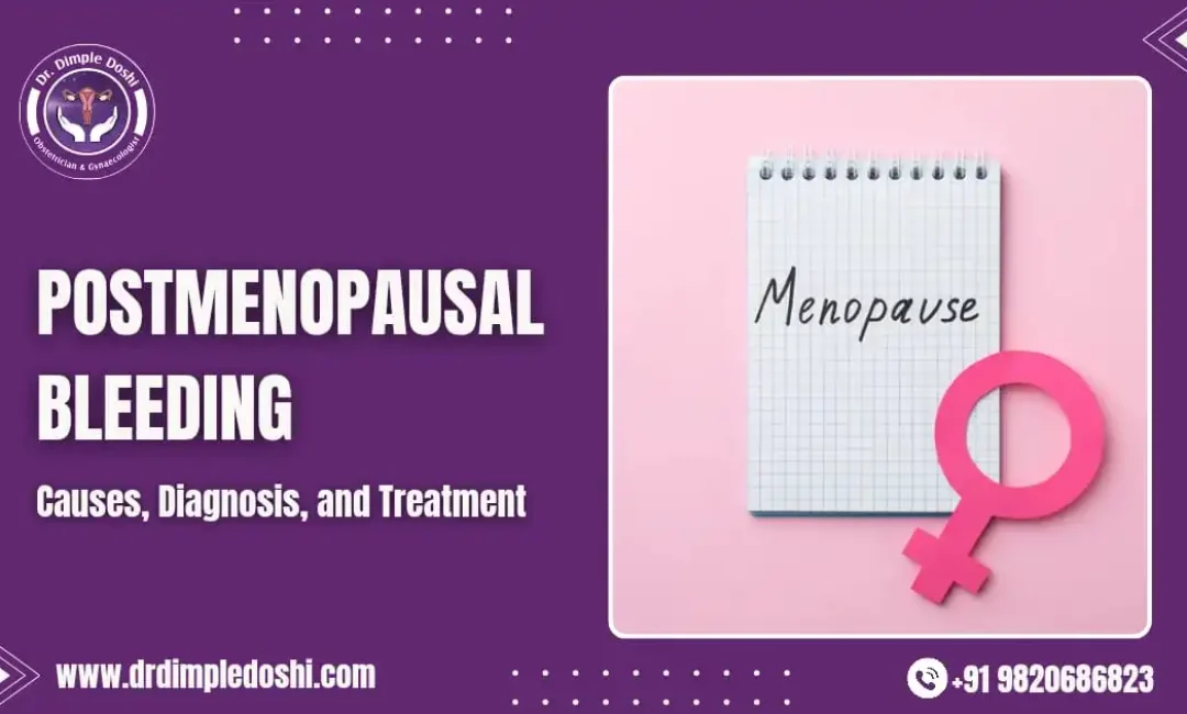 Postmenopausal Bleeding Causes, Diagnosis, and Treatment